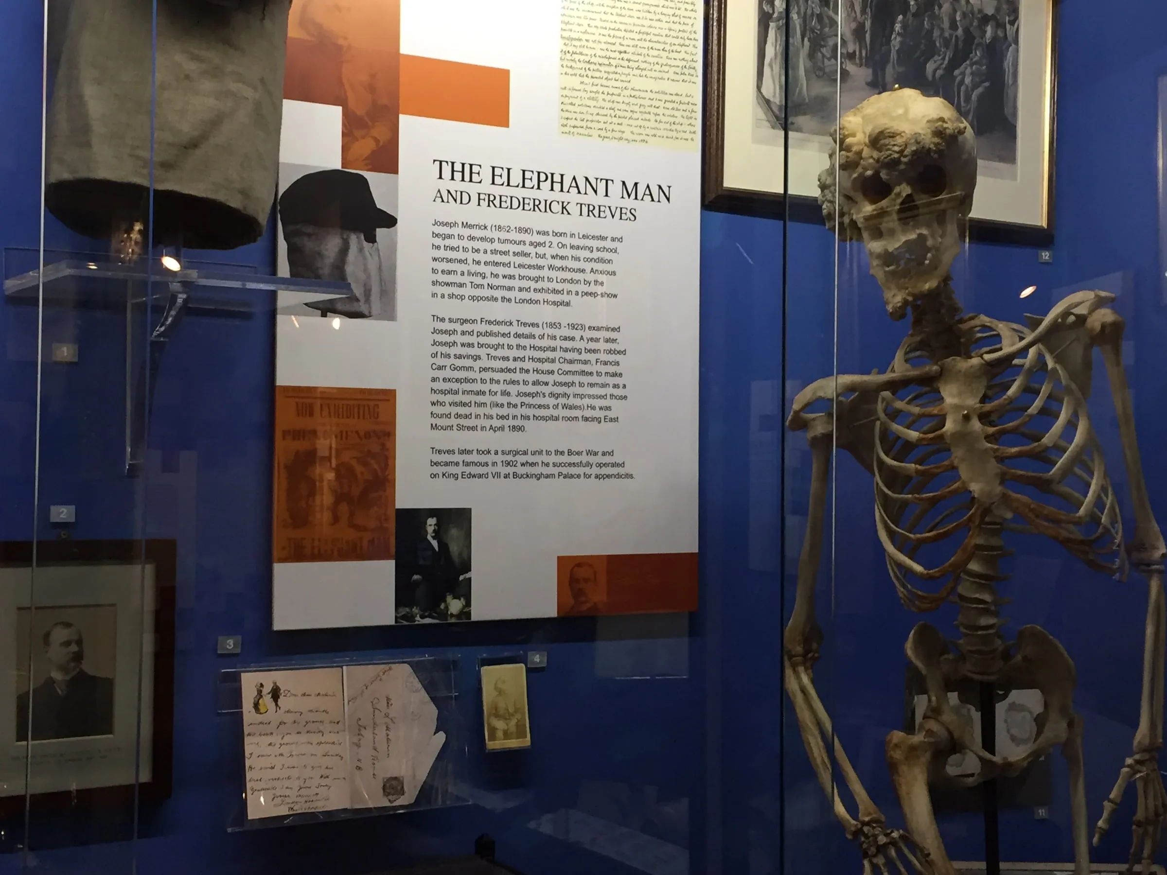 The Elephant Man